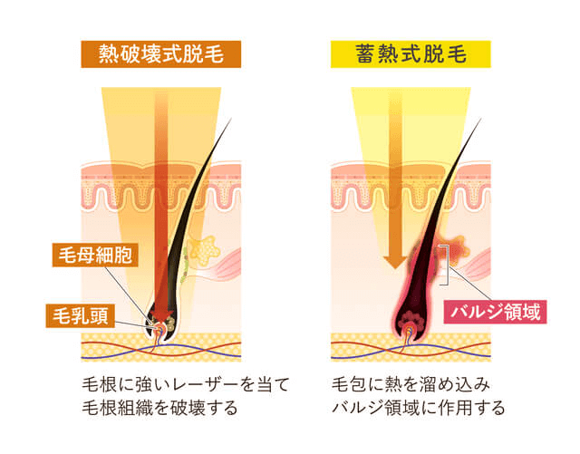 熱破壊式と蓄熱式は熱の強さとターゲットが異なる